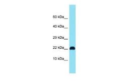 C15orf32 Rabbit anti-Human, Polyclonal, Novus Biologicals 25 &mu;g | Buy Online | Novus Biologicals | Fisher Scientific